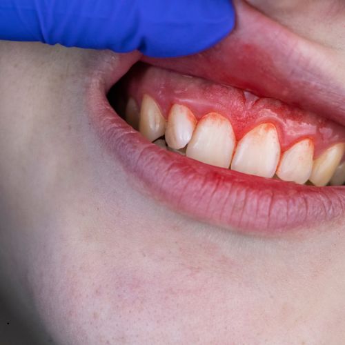 Best Dentistry in Perinthalmanna